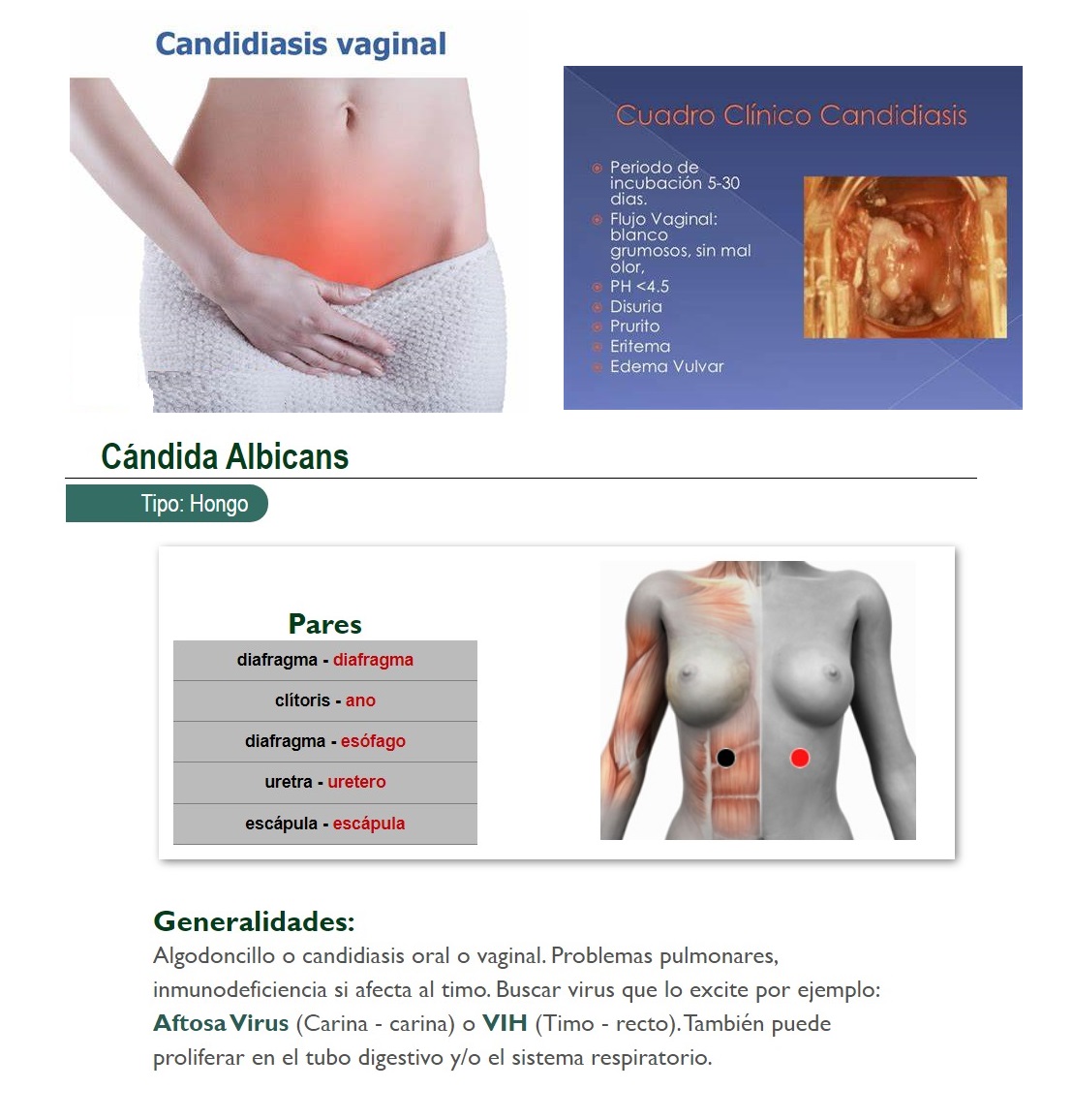 candidiasis